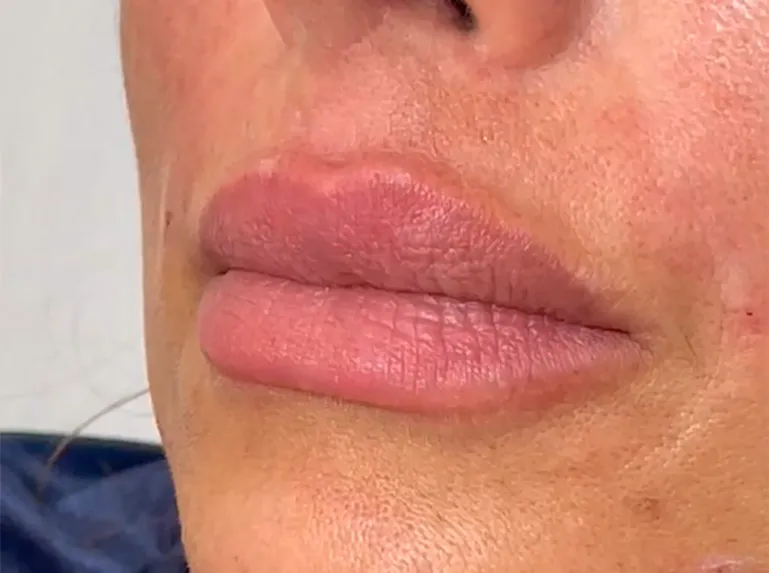 Captura de tela 2026-02-27 103211